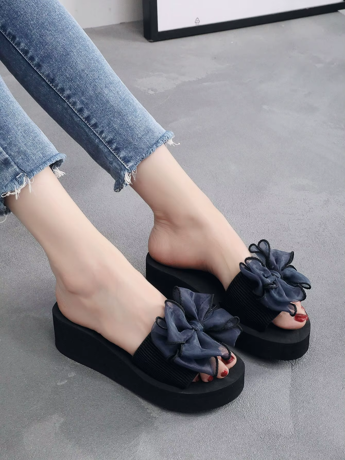 Mireia® - Sandalias Ortopedicas⏐Edición Premium