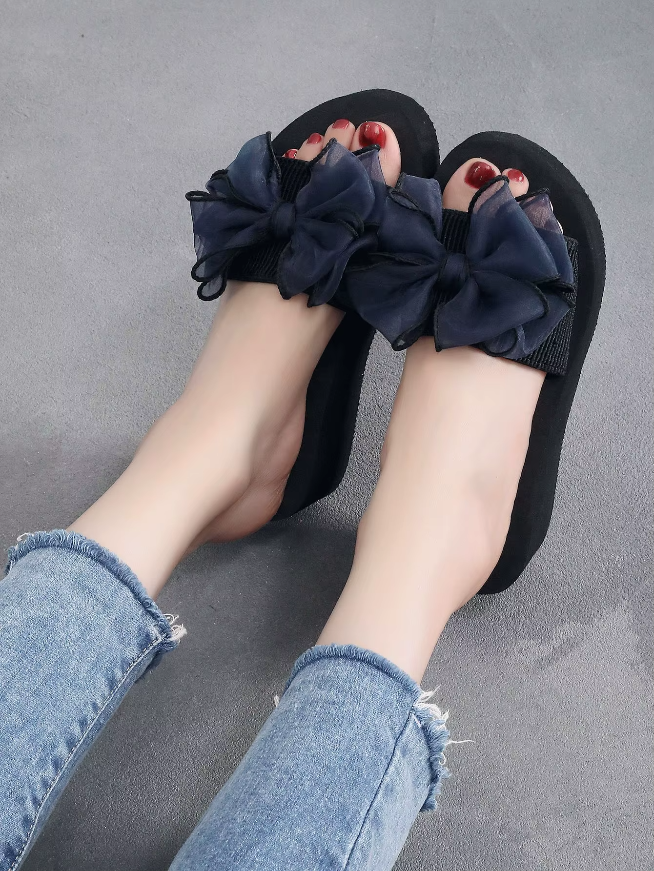 Mireia® - Sandalias Ortopedicas⏐Edición Premium