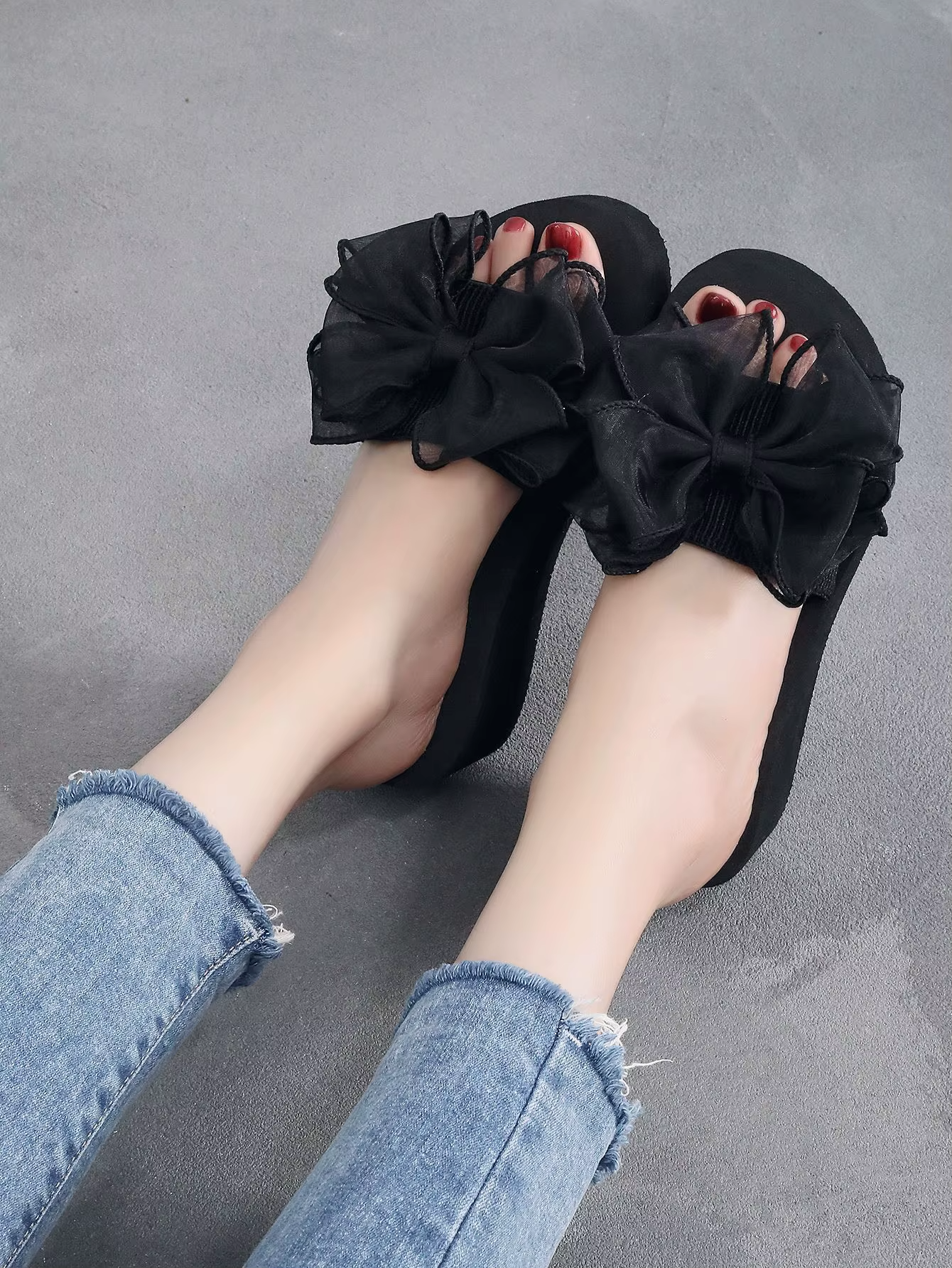 Mireia® - Sandalias Ortopedicas⏐Edición Premium