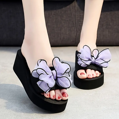 Mireia® - Sandalias Ortopedicas⏐Edición Premium